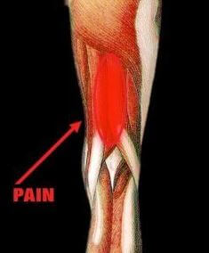 Hamstring Strain or Tear